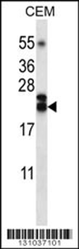 TNFSF4 Antibody (Center)