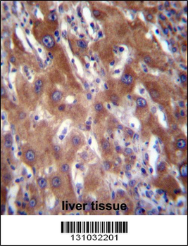 GNE Antibody (N-term)