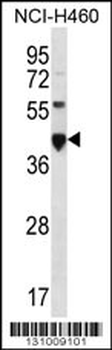 CEACAM18 Antibody (N-term)