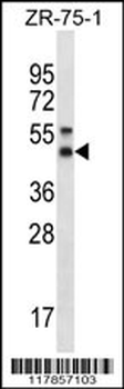 STX5 Antibody (Center)
