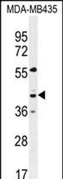 GPR45 Antibody (Center)