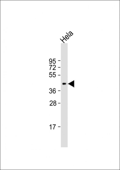 NUDT9 Antibody (C-term)