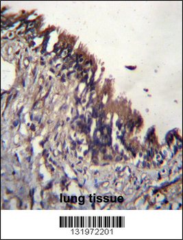 NUDT9 Antibody (C-term)
