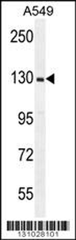 RPGR Antibody (C-term)