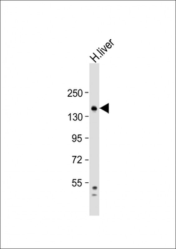 RPGR Antibody (C-term)