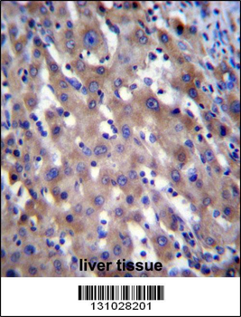 RPGR Antibody (C-term)