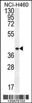 CCNYL3 Antibody (N-term)