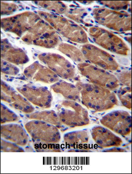 PODNL1 Antibody (Center)