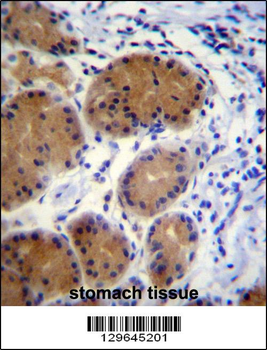 MORN5 Antibody (C-term)