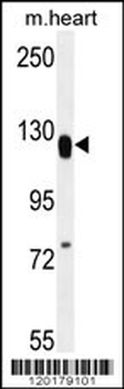 MED14 Antibody (Center)
