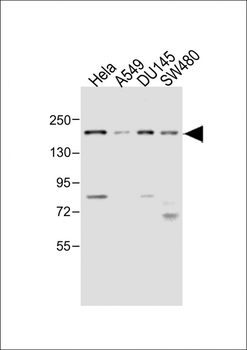 MED14 Antibody (Center)