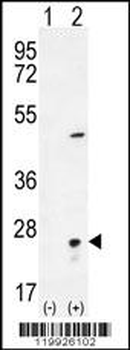 VSNL1 Antibody (Center)
