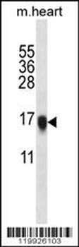 VSNL1 Antibody (Center)