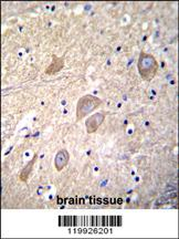 VSNL1 Antibody (Center)