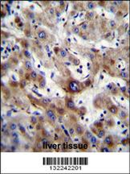 SLC25A6 Antibody (Center)