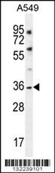 KCNK1 Antibody (C-term)