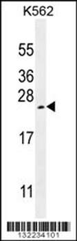 VEGFA Antibody (Center)