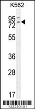 RASGRP2 Antibody (N-term)