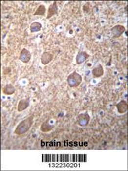 RASGRP2 Antibody (N-term)