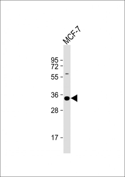STUB1 Antibody (C-term)