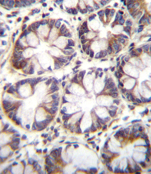 SLC36A1 Antibody (N-term)