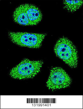 PAK6 Antibody (Center)