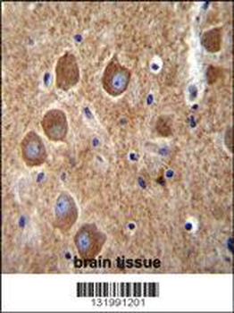 PAK6 Antibody (Center)