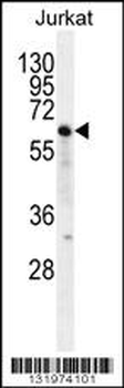 NKD2 Antibody (C-term)