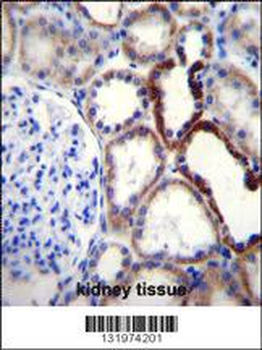 NKD2 Antibody (C-term)