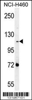 PCDHAC2 Antibody (Center)