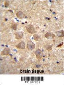 PCDHAC2 Antibody (Center)