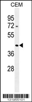 ACTBL3 Antibody (N-term)