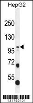 COL21A1 Antibody (N-term)