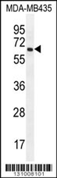 PRAMEF20 Antibody (C-term)