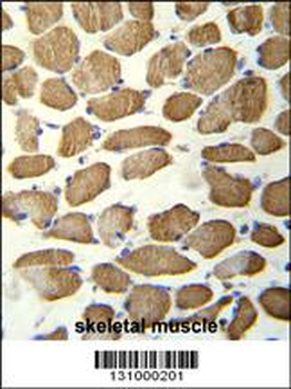 KBTBD13 Antibody (C-term)