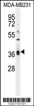KLHL35 Antibody (C-term)