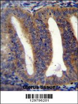 RBPMS2 Antibody (Center)