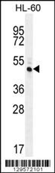 RINL Antibody (N-term)