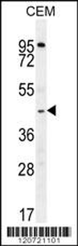 ZMYND10 Antibody (Center)