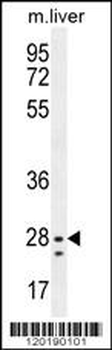 NIPSNAP3B Antibody (C-term)