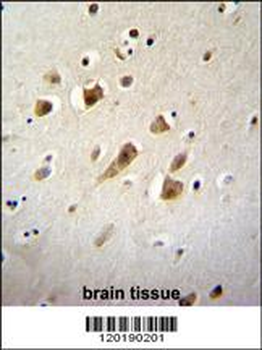 NIPSNAP3B Antibody (C-term)