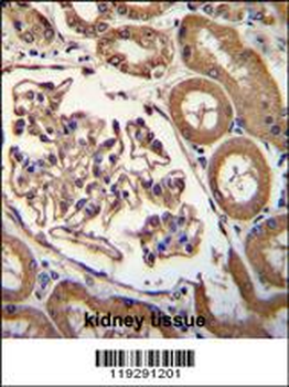 ENPEP Antibody (C-term)