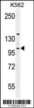 VILL Antibody (Center)