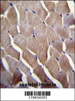 VILL Antibody (Center)