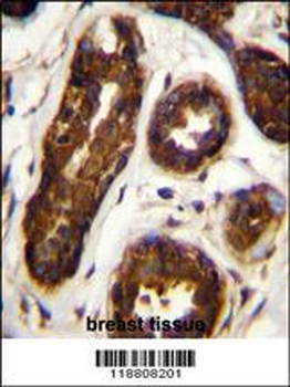 Maspin Antibody (Center)