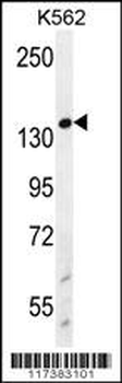 WRN Antibody (Center T802)