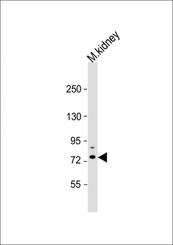 Tiparp Antibody (C-term)