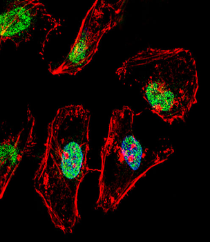 TBX6 Antibody (Center)
