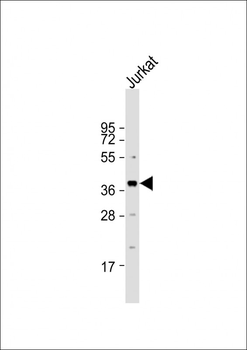 LEF1 Antibody (N-term)