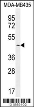 LEF1 Antibody (N-term)